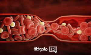 شكل دم الحمل بالصور