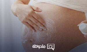 علاج تشققات البطن بعد الولاده