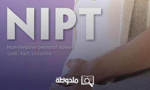تحليل NIPT للحامل